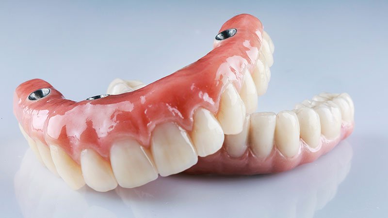 composition of dental prostheses on a white background, for fixation on four implants